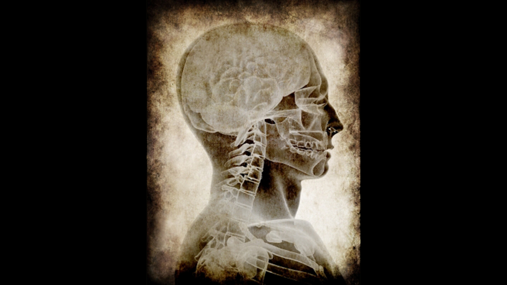 The Physiology of a Neurodegenerative Disease