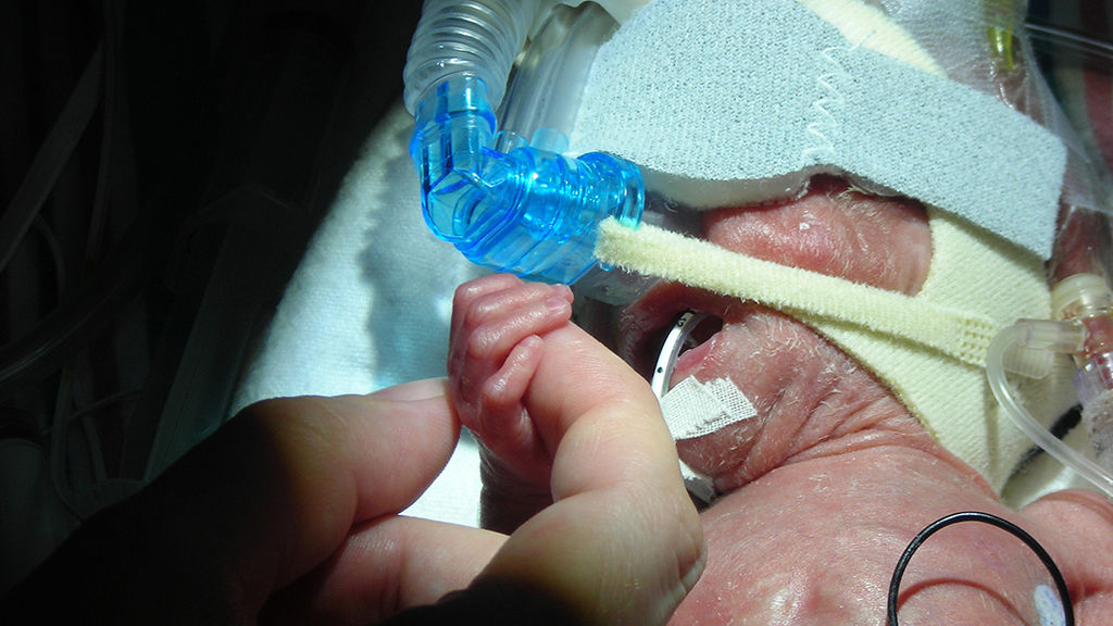 Pulmonary Surfactant