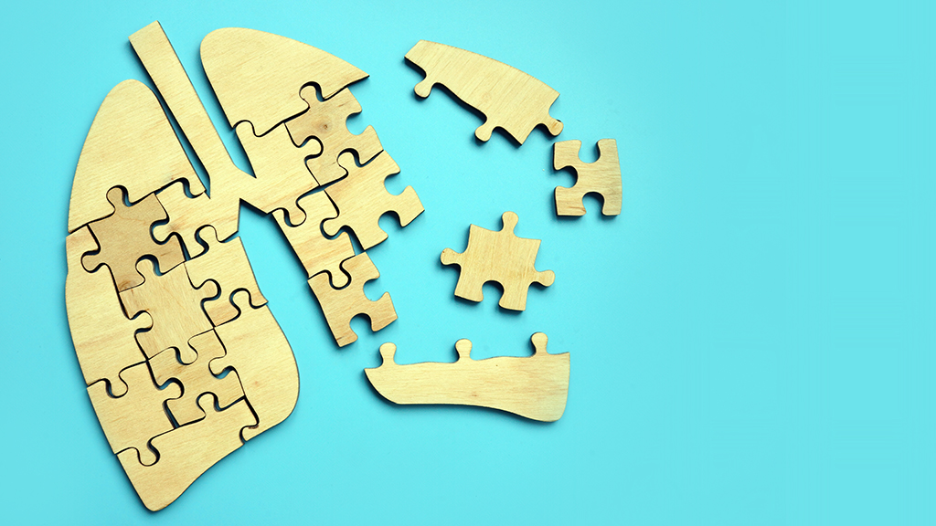 Sometimes It Is All in the Genes