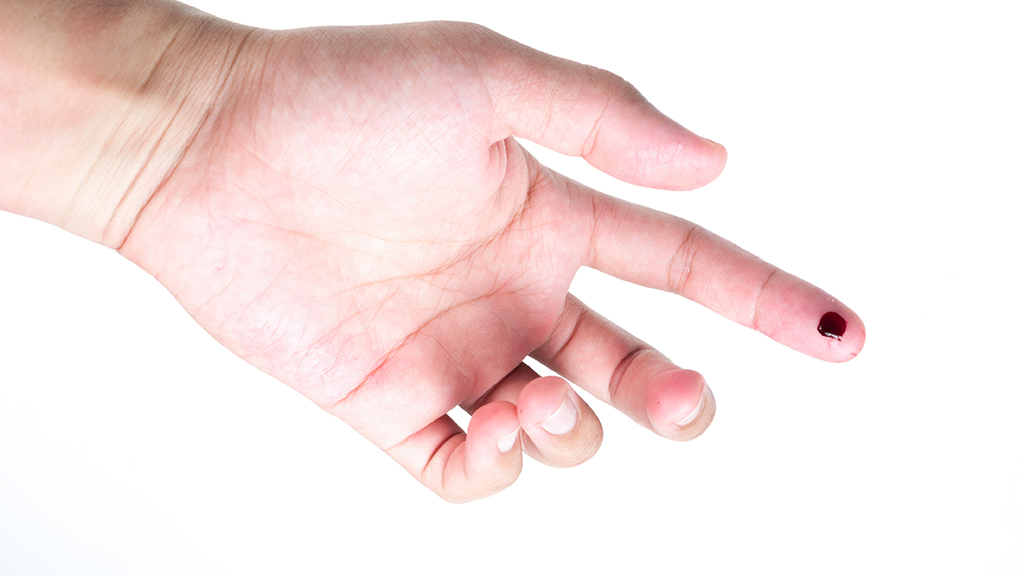 The Unfortunate Nurse