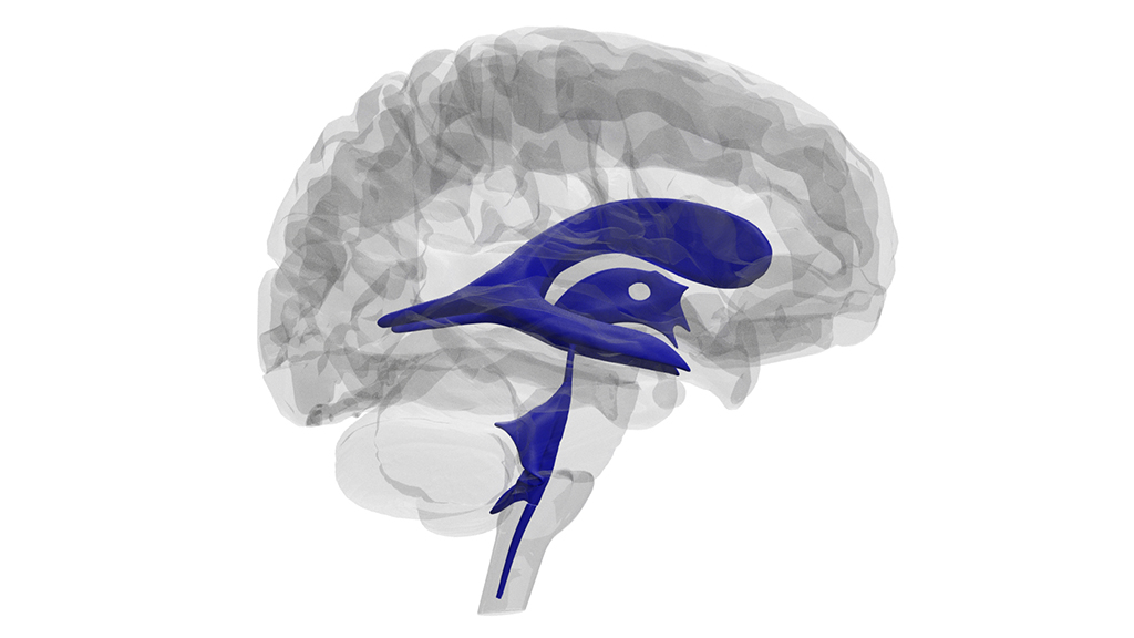 Exploring the Ventricles of the Brain Using a Four-Step Systematic Approach