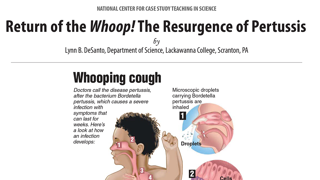 Return Of The Whoop! | NSTA