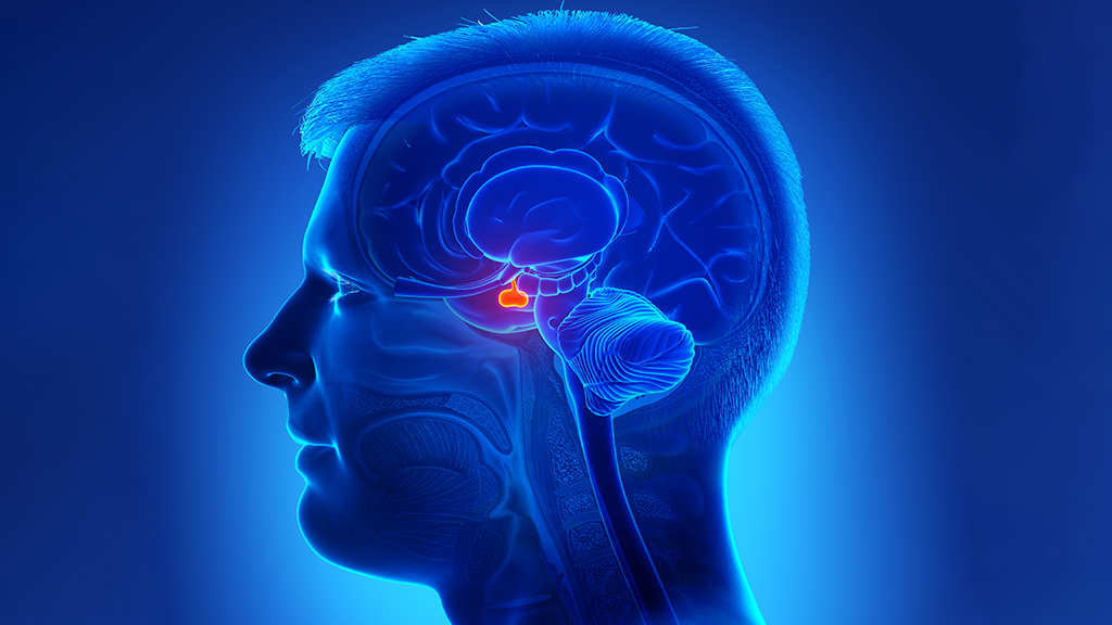 Pituitary Perplexity