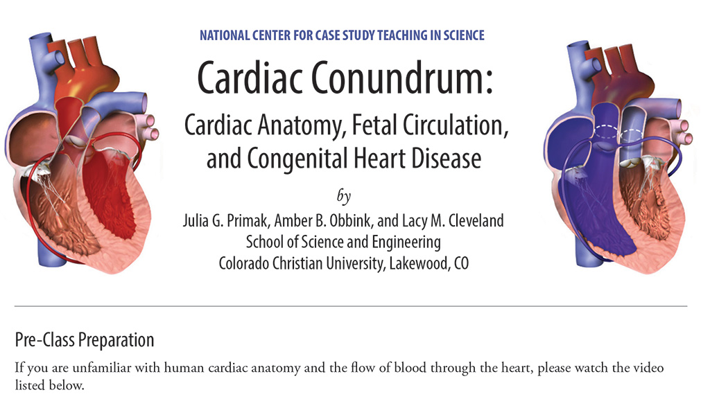 Cardiac Conundrum
