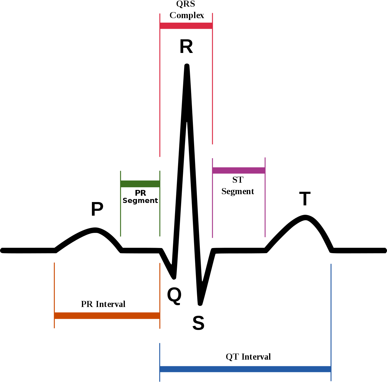 sinus rhythm labels