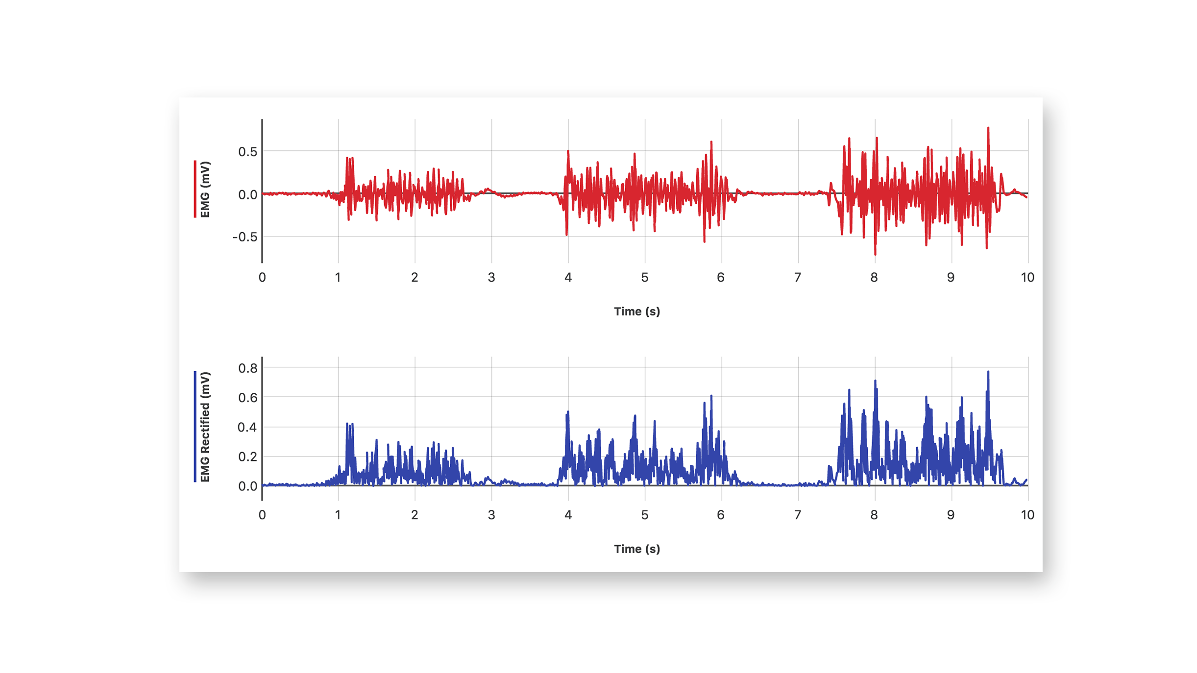 EKG - forearm