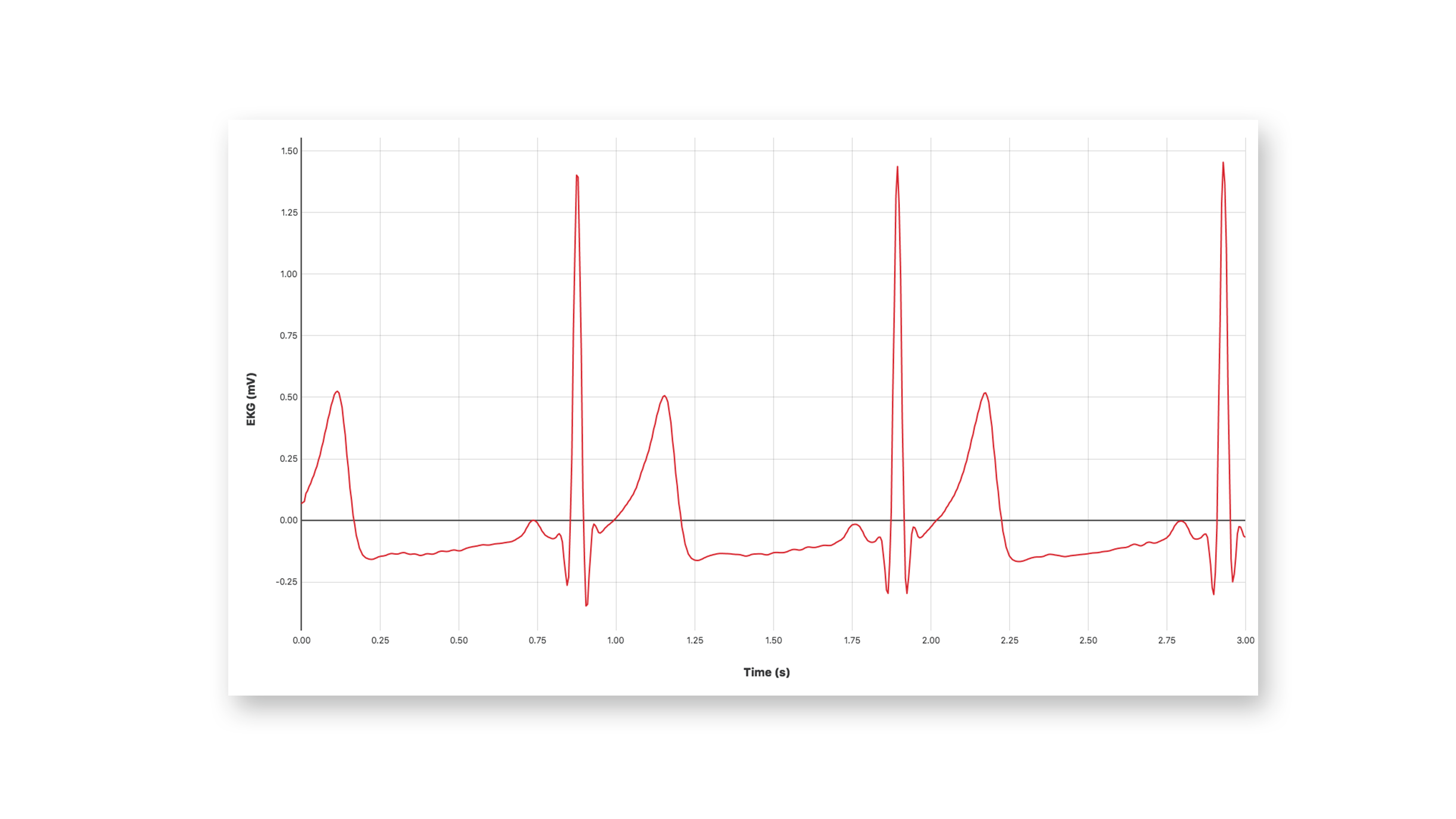 basic EKG trace